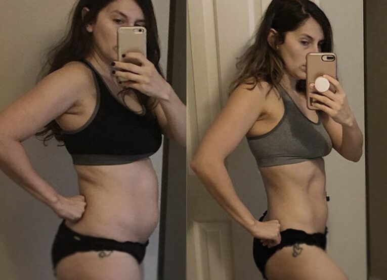 Girl before and after ketogenic diet
